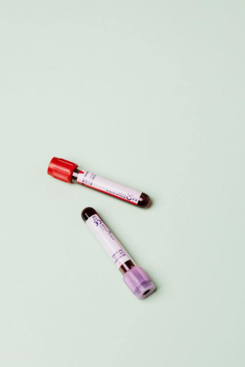 Two blood vials.