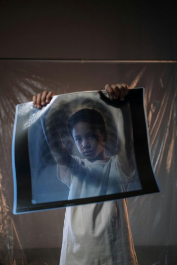 A child holds up an xray and we can see through it to him. He is wearing a cream gown and has short dark hair.