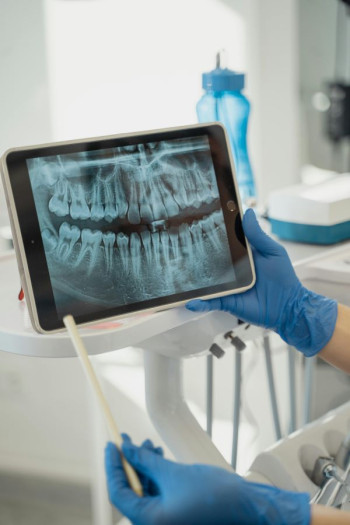 An x-ray of teeth on an ipad